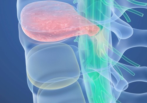 Is a bulging disc a serious injury?